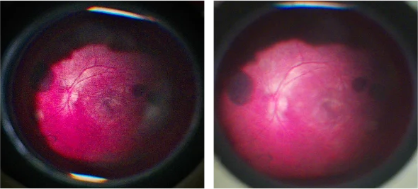 two retinal images of a model eye captured with the retinex prototype during early imaging tests