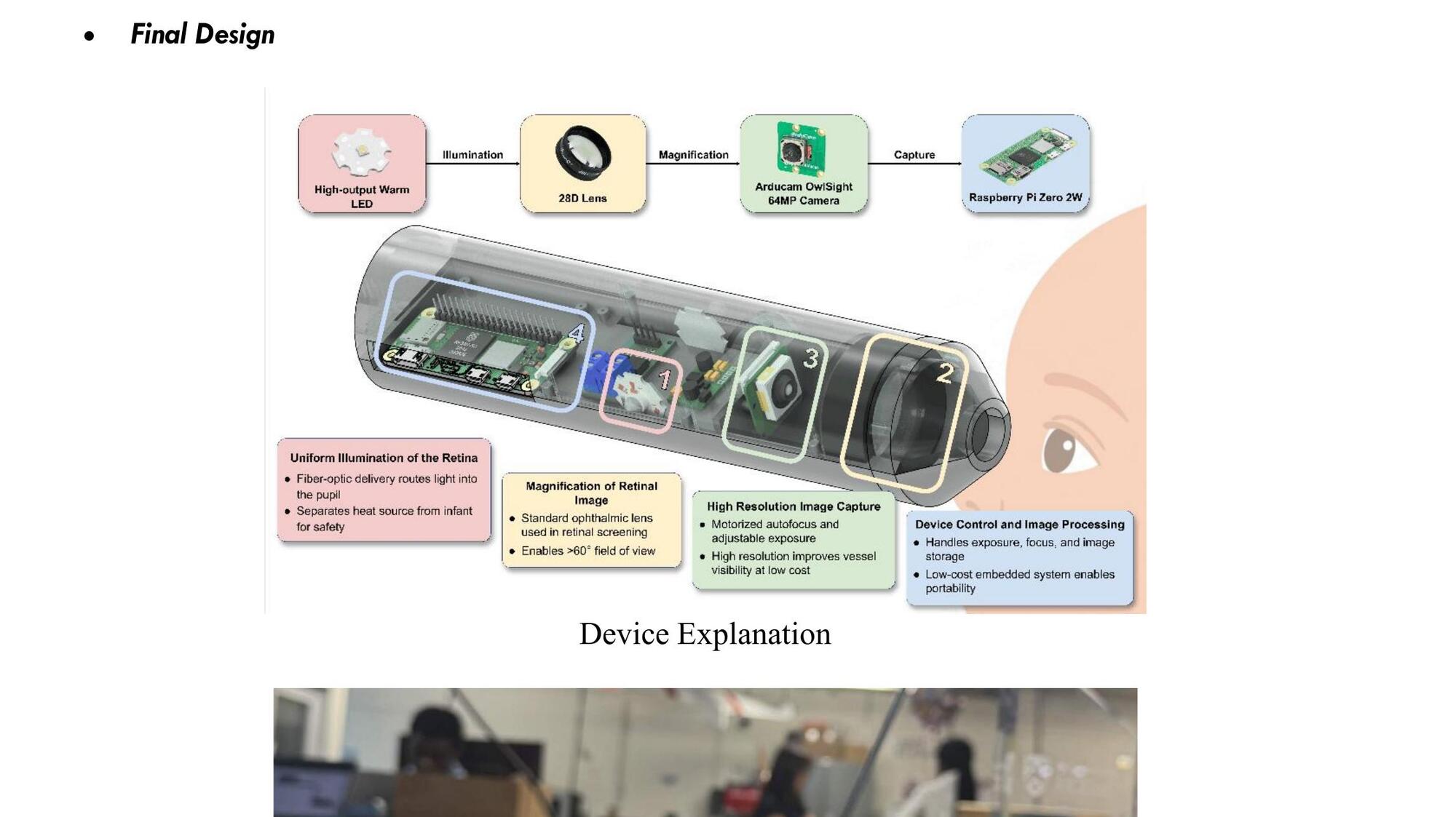 exploded view of the retinex device showing LED, 28D lens, 64MP camera and raspberry pi